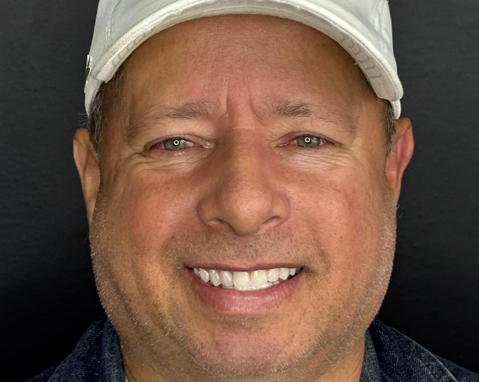 Depois - Estética Dental